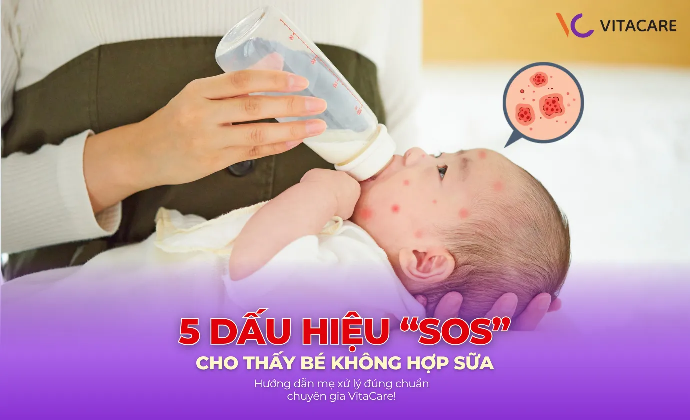 Dấu hiệu bé không hợp sữa công thức