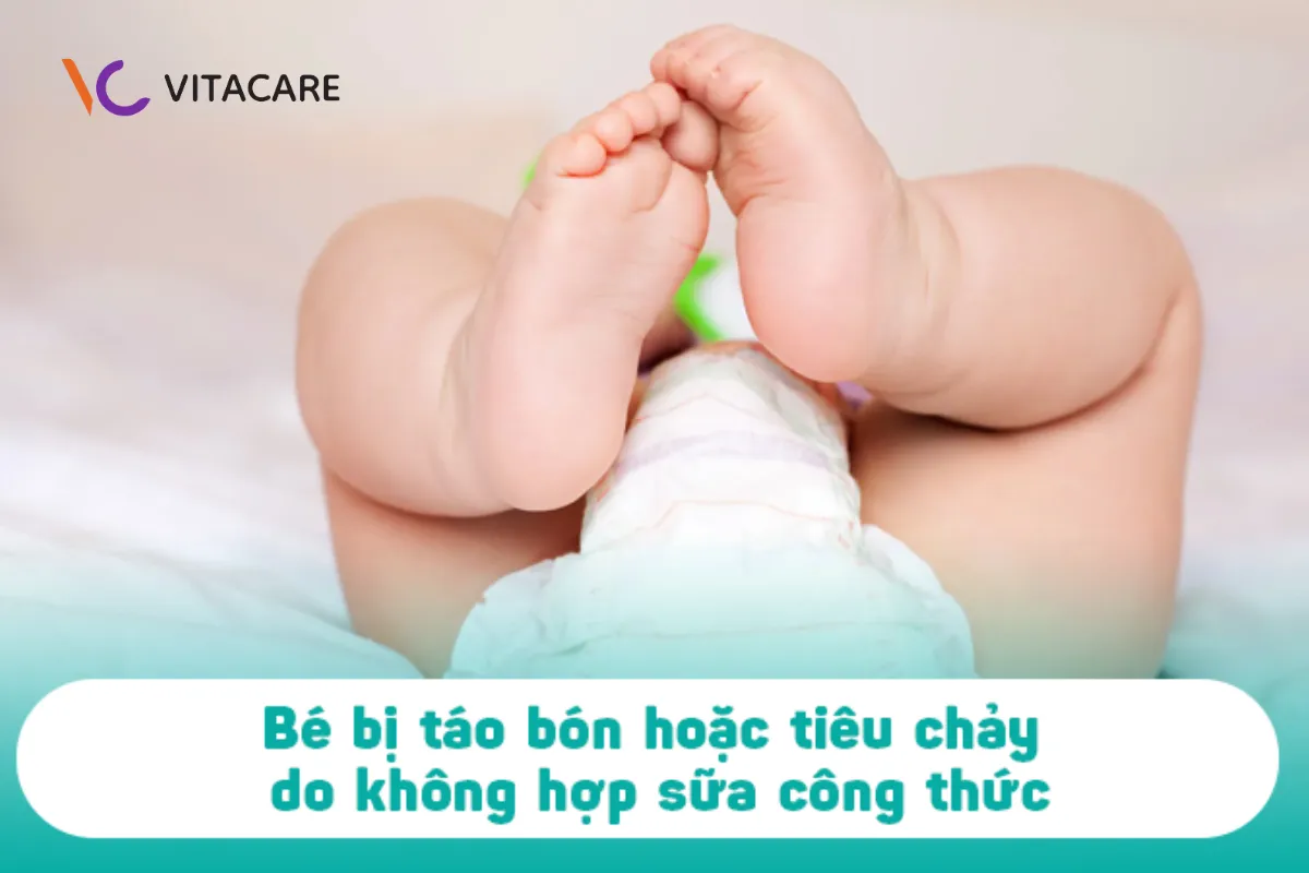 Bé bị táo bón hoặc tiêu chảy do không hợp sữa công thức Bé bị táo bón hoặc tiêu chảy do không hợp sữa công thức