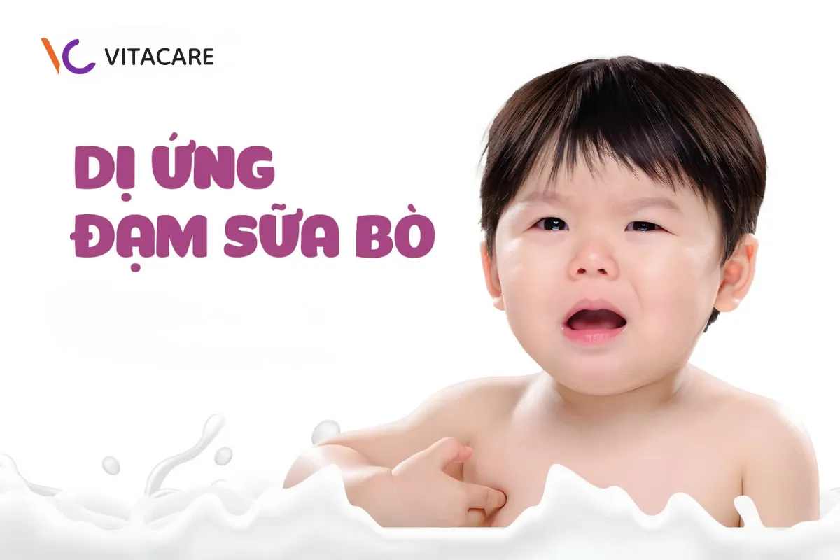 Dị ứng đạm sữa bò là gì? Dị ứng đạm sữa bò là gì?