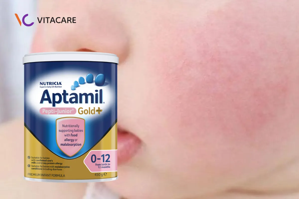 Aptamil Pepti Junior Gold+ với công thức thủy phân hoàn toàn an toàn cho bé dị dứng đạm bò Aptamil Pepti Junior Gold+ với công thức thủy phân hoàn toàn an toàn cho bé dị dứng đạm bò