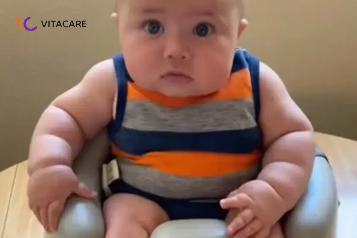 Tăng nguy cơ mắc bệnh chuyển hóa và béo phì Tăng nguy cơ mắc bệnh chuyển hóa và béo phì