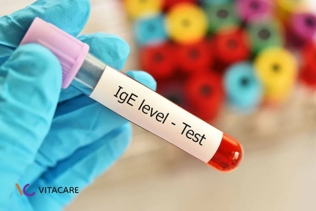 Xét nghiệm định lượng máu IgE đặc hiệu với các protein sữa bò Xét nghiệm định lượng máu IgE đặc hiệu với các protein sữa bò