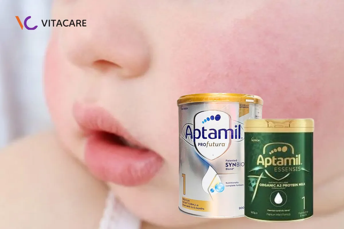 Trẻ bị dị ứng đạm sữa bò có dùng được sữa Aptamil Úc không?