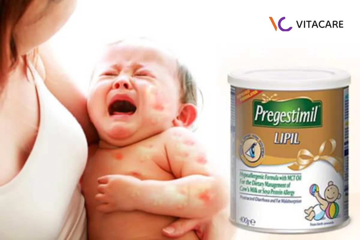 Sữa Pregestimil Lipil thủy phân đặc trị cho bé dị ứng nặng Sữa Pregestimil Lipil thủy phân đặc trị cho bé dị ứng nặng