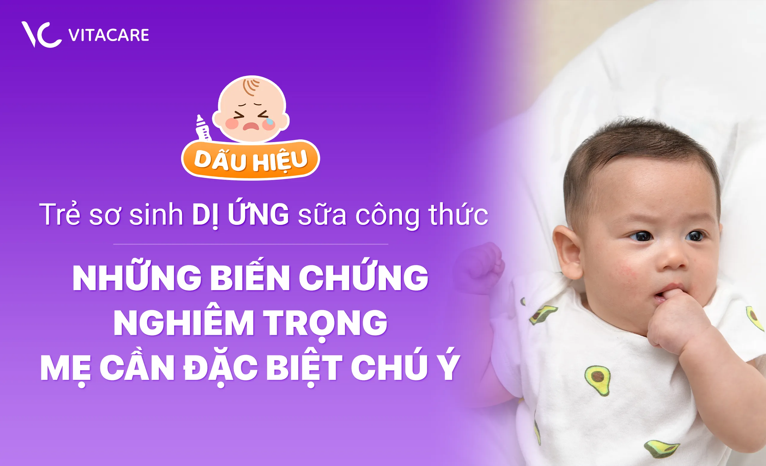 Dấu hiệu trẻ sơ sinh dị ứng sữa công thức
