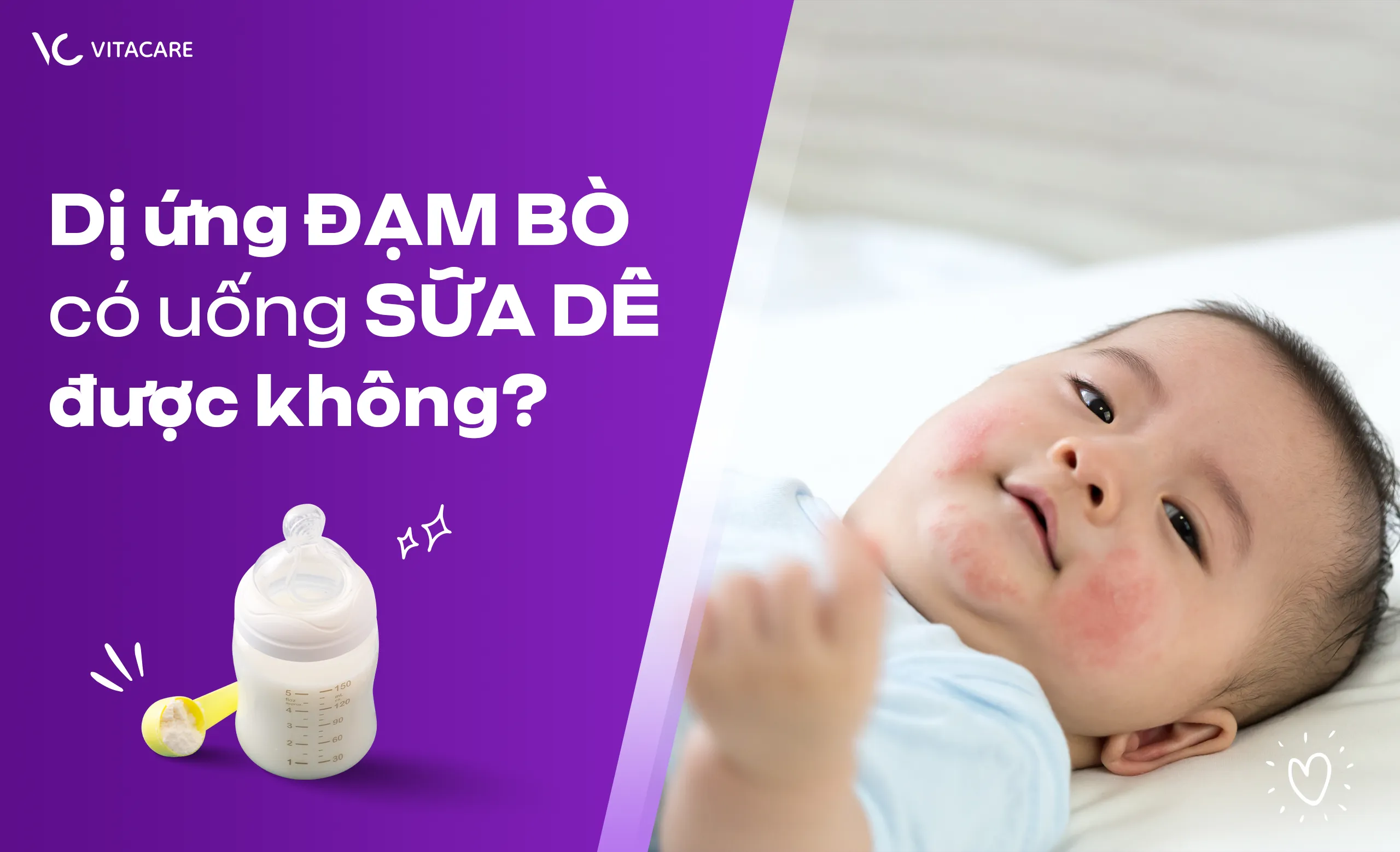 Dị ứng đạm bò có uống sữa dê được không