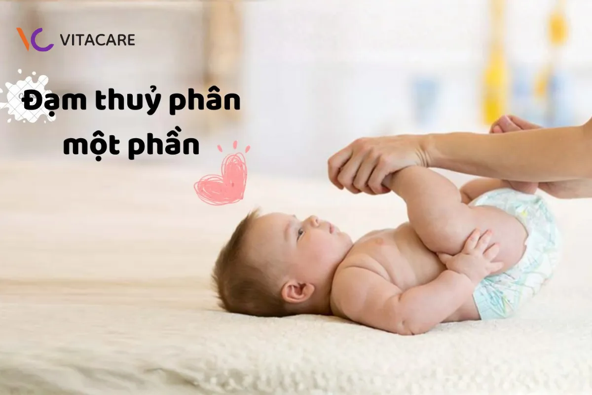 Sữa thủy phân 1 phần là gì?