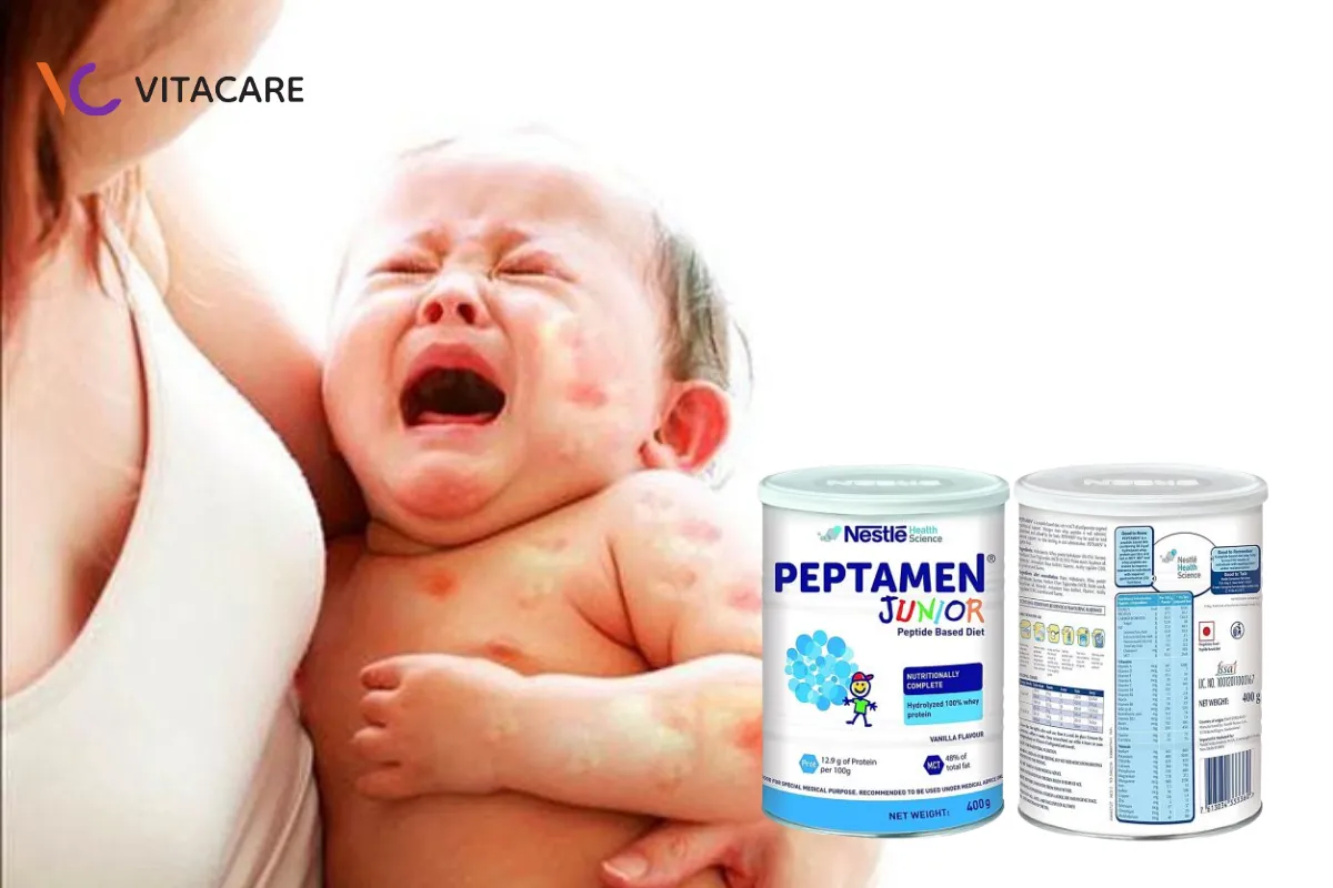 Sữa thủy phân hoàn toàn Peptamen Junior
